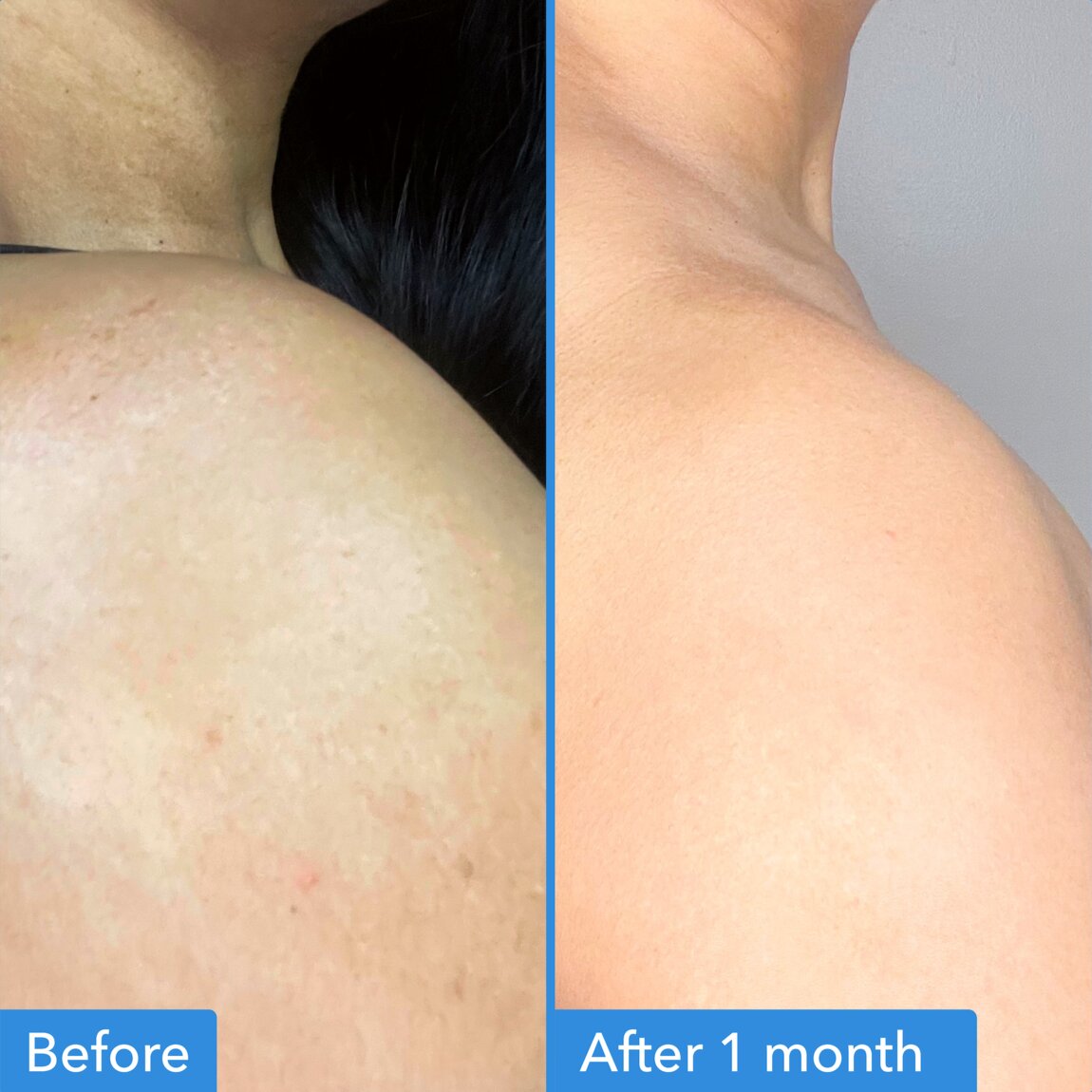 discoloration-correcting-body-treatment-y2 zb_p.jpg