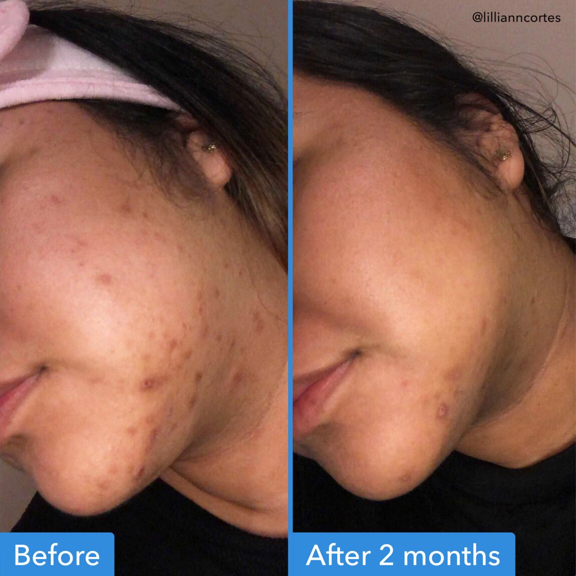 discoloration-correcting-serum-f1 zb_p.jpg